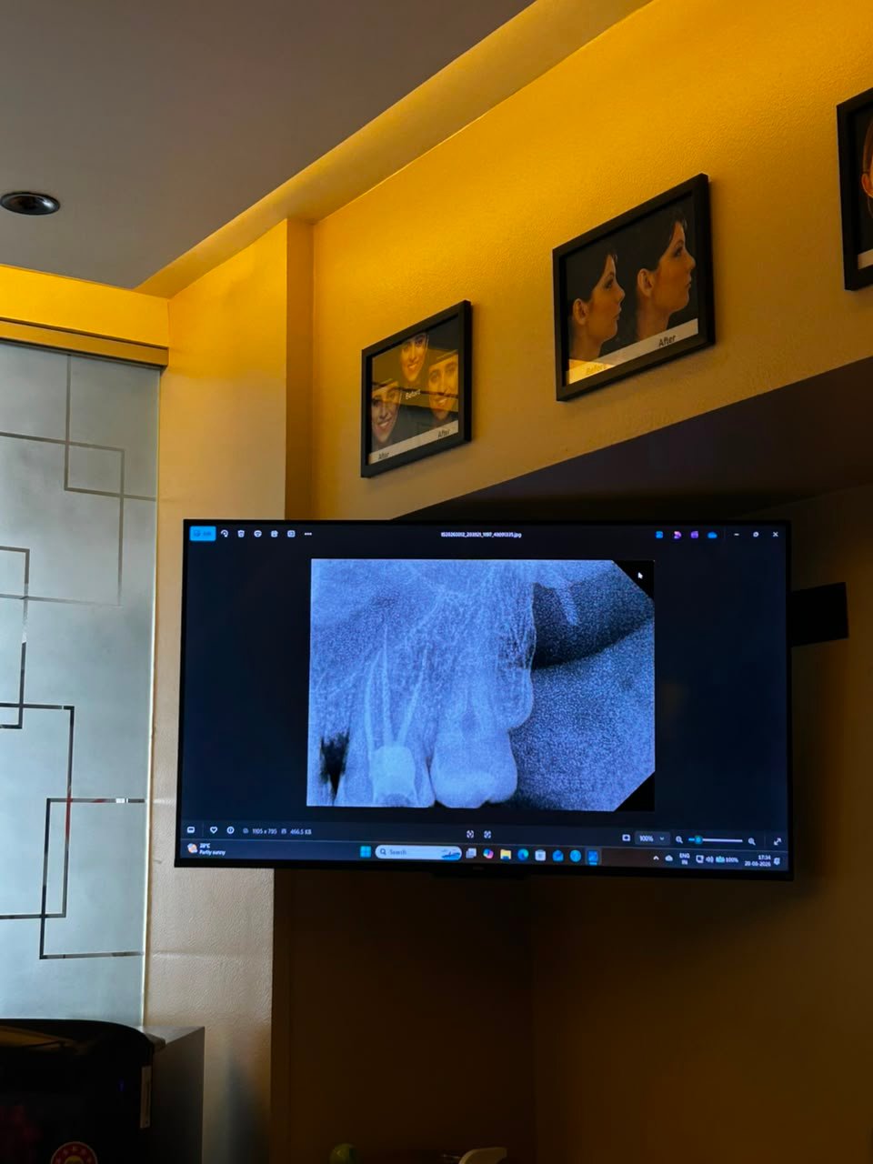Digital Radiography